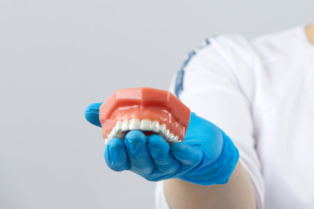 Orthodontist showing the system of aligners on artificial jawsの写真素材