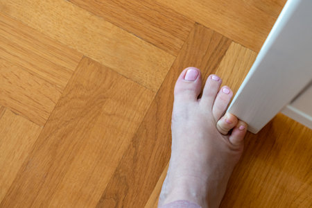 Woman hit furniture with the little toe. Incident at home. Injury of foot little fingerの写真素材