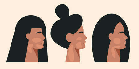 Women silhouette with vitiligo chronic skin pigmentation disorder. World vitiligo day concept....