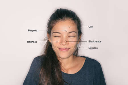 Skin care problems asian woman with skincare conditions - oily forehead, dry lips, redness around...