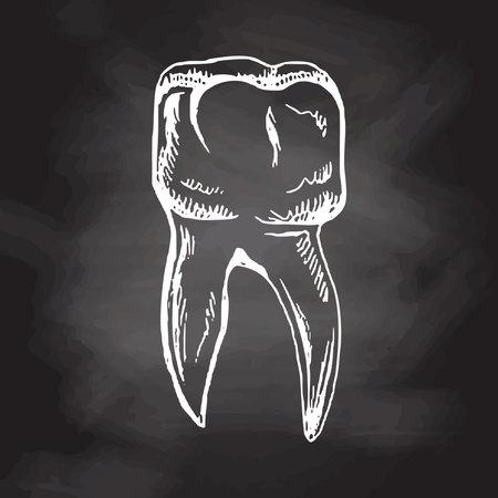 Highly detailed hand drawn human tooth with roots. hand drawn sketch. Molar illustration isolated on chalkboard background.のイラスト素材