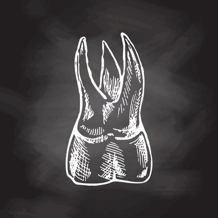 Highly detailed hand drawn human tooth with roots. hand drawn sketch. Molar illustration isolated on chalkboard background.のイラスト素材