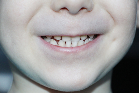 Smile of a little boy. Baby teeth baby. Clean, beautiful teeth of a boy. Care for baby teeth.の写真素材