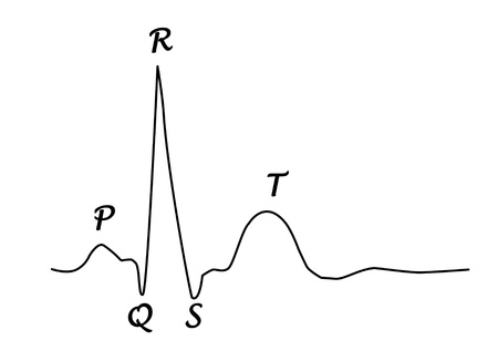 ECG graph with heart