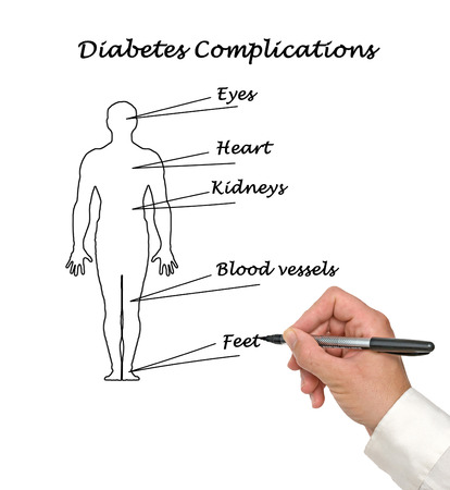  diabetes complicationsの写真素材