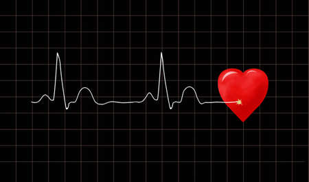 ECG graph