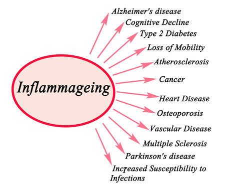 Consequences of Inflammageingの写真素材