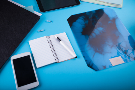 Doctor's workspace. Roentgen image of intestines on blue background.の写真素材