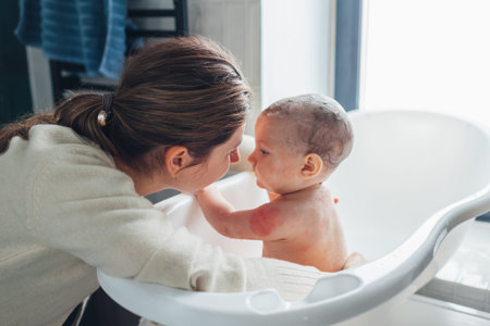 Atopic dermatitis skin care. Mother bathing her daughter with eczema. Mom taking care of infant baby...