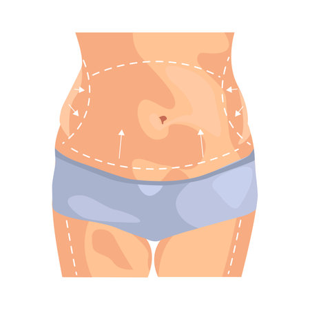 Body correction illustration in color cartoon style. Editable vector graphic design.のイラスト素材