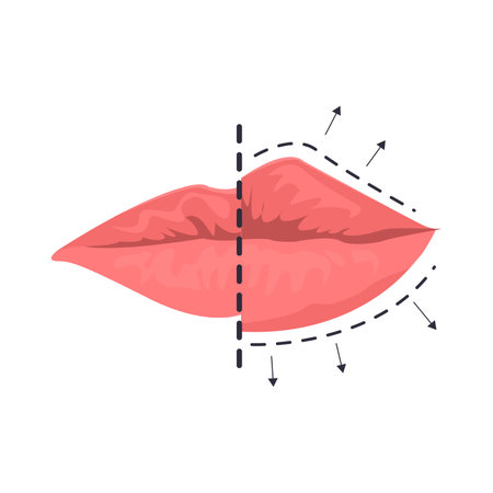 Lip augmentation illustration in color cartoon style. Editable vector graphic design.のイラスト素材