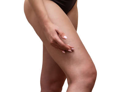 Crop photo of young woman applying cosmetic cream to her hip standing in the bathroom on white tile background. Close-up. Skin care concept.の写真素材