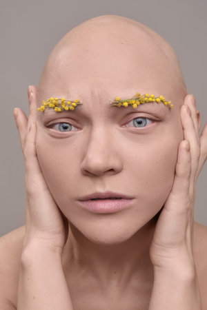 A beautiful woman without hair with flowers on her head, a conceptual photo with an unusual modelの写真素材