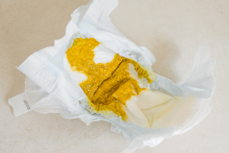 defecation of a breastfed infantの写真素材