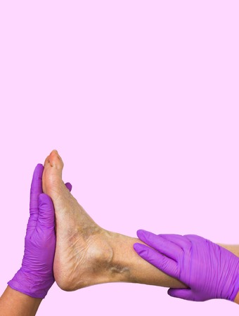 Lower limb vascular examination because suspect of venous insufficiency.の写真素材