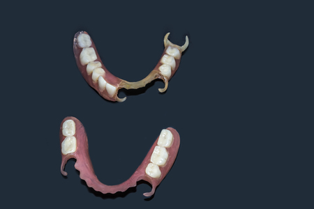 Removable dentures flexible, devoid of nylon, hypoallergenic exempt from monomer.
