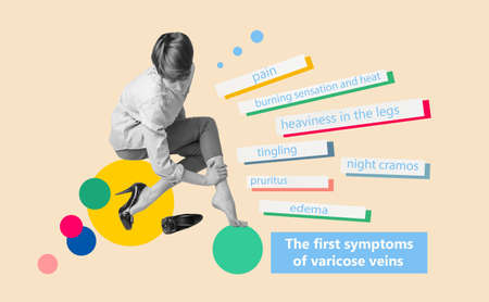 First symptoms of varicose veins. Young woman in high heels massaging her tired legs. Varicose veins concept. Painful varicose and spider veins on female legs.の写真素材