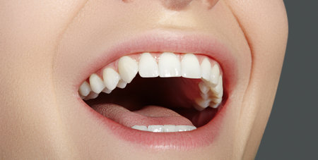 Dental Beauty. Beautiful Macro with perfect White Teeth. Fashion Naturel Lips Make-up. Whitening...