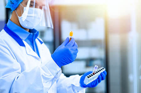 Medical worker, laboratory assistant holds test tubes with biomaterial in his hands. A medical...