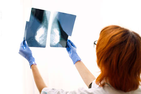 The doctor looks at the x-ray of the female mammary glands. Hardware examination of the breast.