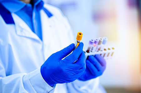 Medical workers, laboratory assistants work with test tubes for the analysis of biomaterials in...