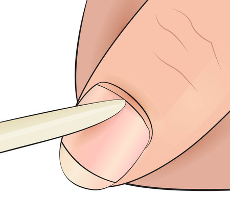 Illustration with removing cuticle using wooden ecoのイラスト素材