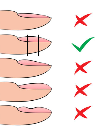 Illustration with hardware manicure technology. Correct formation of the nail shape and errorsのイラスト素材