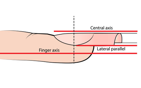 Illustration with hardware manicure technology. Correct nail shapeのイラスト素材