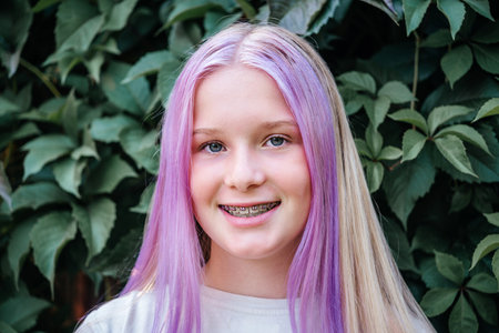 Smiling teen girl wearing dental braces, cute caucasian girl with pink hair wearing orthodontic bracketsの写真素材