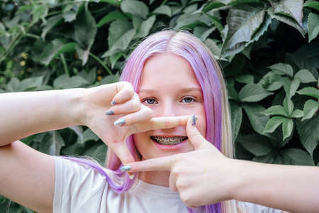 Happy girl wearing dental braces on dark green vine background, cute caucasian girl with pink hair wearing orthodontic bracketsの写真素材