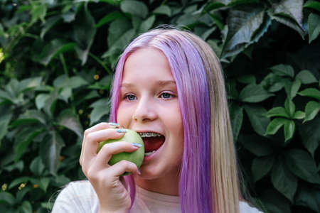 Pink haired teenage girl in dental braces holding an apple, eating apple with orthodontic bracketsの写真素材