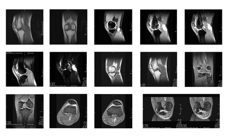MRI images - Kneeの写真素材