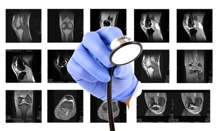 MRI images - Kneeの写真素材