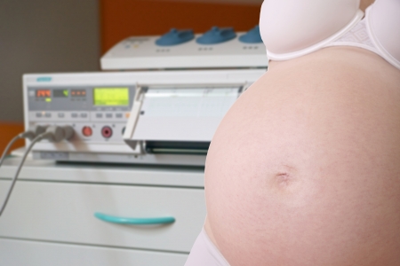 pregnant woman at CTGの写真素材