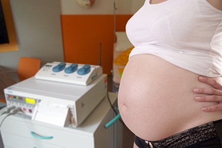 pregnant woman at CTGの写真素材