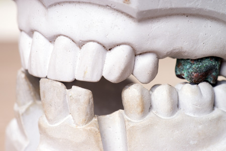 Model of a human teethの写真素材