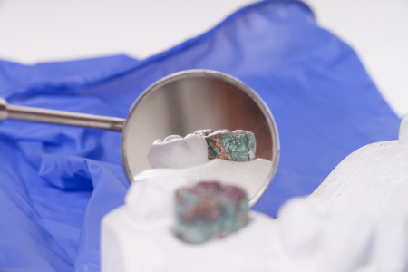 Mouth mirror and model of a human teethの写真素材