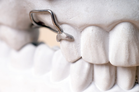 Model of a human teethの写真素材