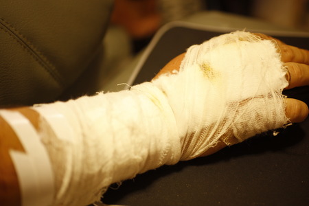 Physical human injury wound medicine healthcare. macroの写真素材