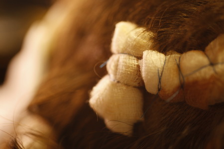 Bandage on human brain concussion wound headの写真素材