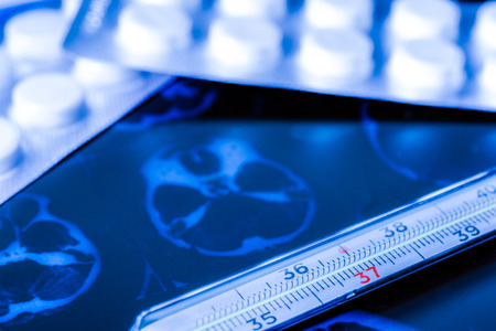 X-ray examination, thermometer and tablets for treatment of diseaseの写真素材