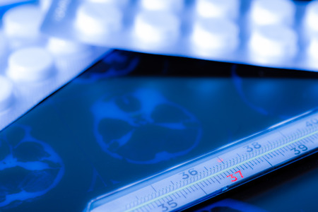 X-ray examination, thermometer and tablets for treatment of disease. In soft tonesの写真素材