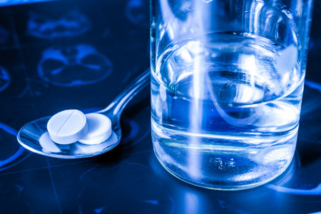 X-ray examination, a glass of the water and a pills in the spoon for treatment of diseaseの写真素材