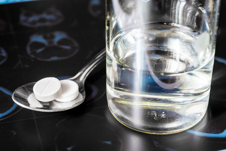 X-ray examination, a glass of the water and a pills in the spoon for treatment of diseaseの写真素材