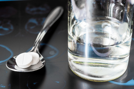 X-ray examination, a glass of the water and a pills in the spoon for treatment of diseaseの写真素材