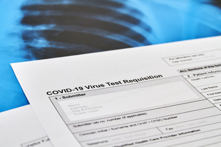 A part of COVID-19 Virus test Requisition form on the background of lung x-ray. Concept of...