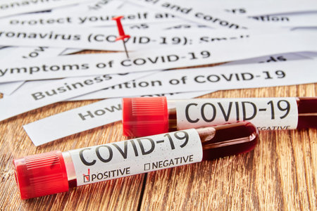 Conceptual photo. Blood test samples for presence of coronavirus tube containing a blood sample that...