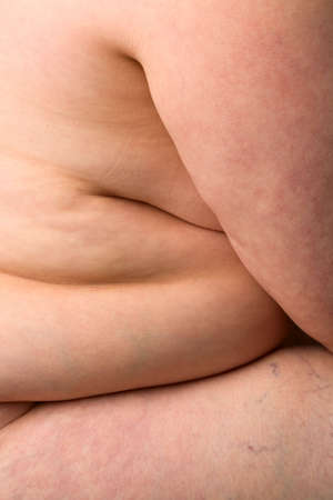 Close-up of fat woman's mid-sectionの写真素材