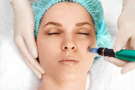 Medical, cosmetological procedure for cleaning the skin, cleaning the pores with a special tool on the face. Skin care, cosmetic proceduresの写真素材