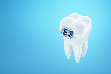 White teeth with metal braces on a blue background. Dental braces, orthodontic treatment, dentistry, teeth whitening, protection, oral care, hygiene, healthcare. 3D illustration, 3D renderingの写真素材